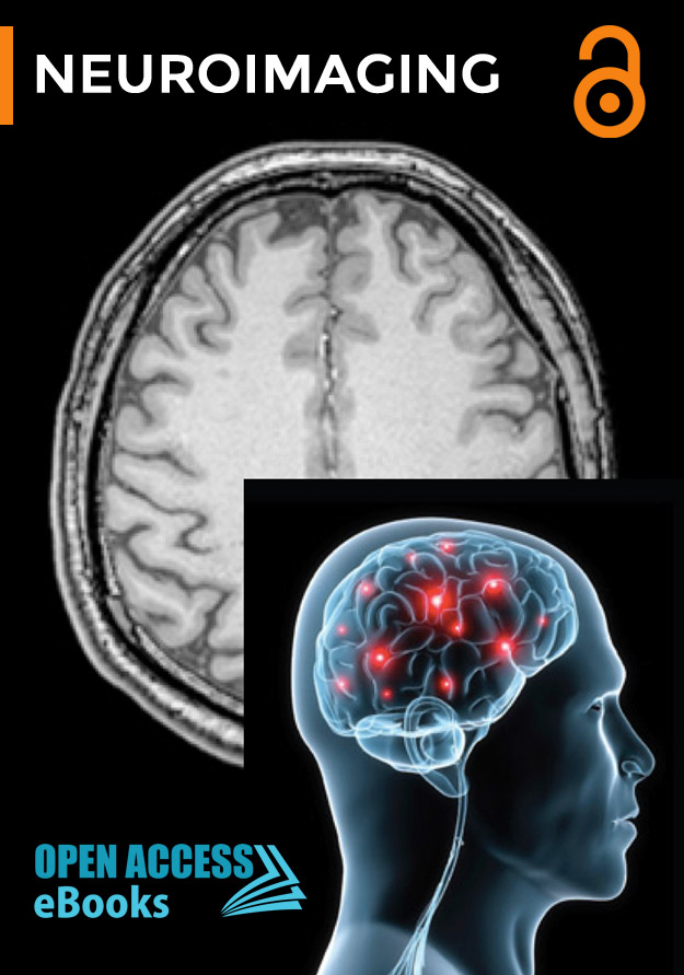 neuroimaging