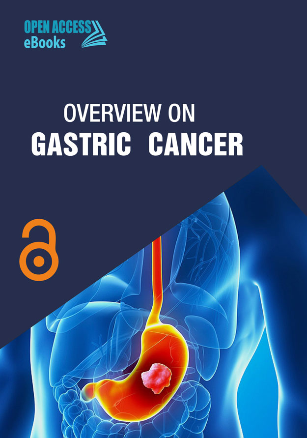 overview-on-gastric-cancer